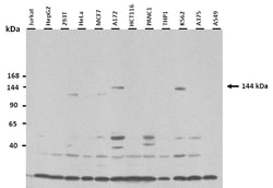 Aviva Systems Biology Corp KIAA0999 Antibody - middle region (ARP53784_P050)