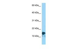 Aviva Systems Biology Corp LAMA4 Antibody - C-terminal region (ARP54550_P050)