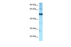 Aviva Systems Biology Corp Shpk Antibody - C-terminal region (ARP54926_P050)
