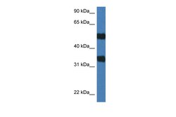 Aviva Systems Biology Corp Arsg Antibody - C-terminal region (ARP55122_P050)