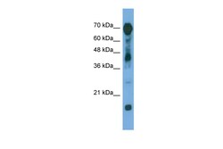 Aviva Systems Biology Corp RAP1GAP Antibody - middle region (ARP56512_P050)