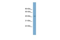 Aviva Systems Biology Corp CXorf9 Antibody - C-terminal region (ARP57306_P050)
