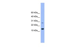 Aviva Systems Biology Corp GLRX2 Antibody - middle region (ARP57792_P050)