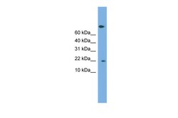 Aviva Systems Biology Corp PTGES3 Antibody - middle region (ARP58321_P050)