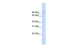 Aviva Systems Biology Corp ZNF224 Antibody - middle region (ARP58369_P050)