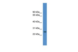 Aviva Systems Biology Corp EIF4E2 Antibody - N-terminal region (ARP58898_P050)