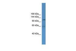 Aviva Systems Biology Corp UBA6 Antibody - middle region (ARP59384_P050)