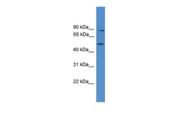 Aviva Systems Biology Corp ZER1 Antibody - middle region (ARP59408_P050)