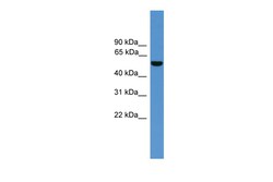Aviva Systems Biology Corp ALDH9A1 Antibody - C-terminal region (ARP59590_P050)
