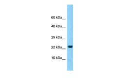 Aviva Systems Biology Corp Hint2 Antibody - middle region (ARP60264_P050)