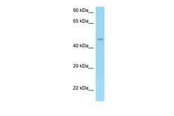 Aviva Systems Biology Corp AMACR Antibody - middle region (ARP60807_P050)