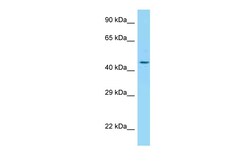 Aviva Systems Biology Corp ADIPOR2 Antibody - C-terminal region (ARP60819_P050)