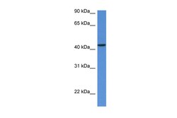 Aviva Systems Biology Corp MVD Antibody - N-terminal region (ARP61094_P050)