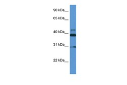 Aviva Systems Biology Corp VASP Antibody - middle region (ARP61210_P050)