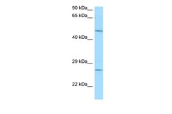 Aviva Systems Biology Corp Entpd1 Antibody - N-terminal region (ARP61262_P050)