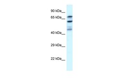 Aviva Systems Biology Corp EIF2B5 Antibody - N-terminal region (ARP61329_P050)