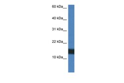 Aviva Systems Biology Corp H2AFZ Antibody - C-terminal region (ARP61353_P050)