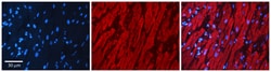 Aviva Systems Biology Corp AKR1C3 Antibody - N-terminal region (ARP61430_P050)