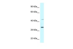 Aviva Systems Biology Corp BST1 Antibody - middle region (ARP61591_P050)