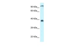 Aviva Systems Biology Corp DOK7 Antibody - C-terminal region (ARP61801_P050)