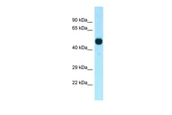 Aviva Systems Biology Corp Cdk14 Antibody - C-terminal region (ARP61958_P050)