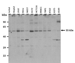 Aviva Systems Biology Corp POLG2 Antibody - N-terminal region (ARP61960_P050)