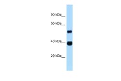 Aviva Systems Biology Corp ASB4 Antibody - middle region (ARP62054_P050)