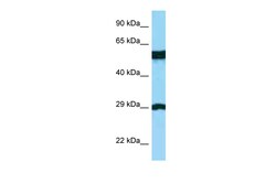 Aviva Systems Biology Corp BSPRY Antibody - C-terminal region (ARP62377_P050)
