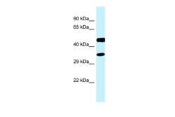 Aviva Systems Biology Corp RDH13 Antibody - C-terminal region (ARP62403_P050)