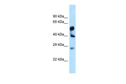 Aviva Systems Biology Corp LPGAT1 Antibody - C-terminal region (ARP62465_P050)