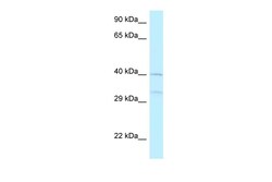 Aviva Systems Biology Corp AZI2 Antibody - middle region (ARP62739_P050)