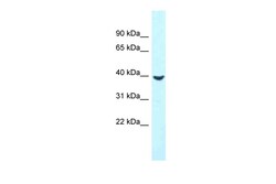 Aviva Systems Biology Corp MTUS2 Antibody - C-terminal region (ARP62853_P050)