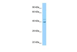 Aviva Systems Biology Corp UBE2Q1 Antibody - middle region (ARP62941_P050)