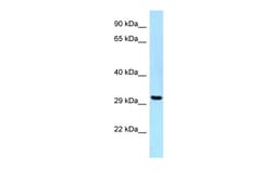Aviva Systems Biology Corp UBE2Z Antibody - C-terminal region (ARP62944_P050)