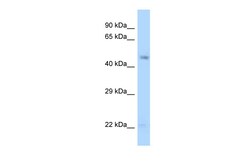 Aviva Systems Biology Corp GDA Antibody - N-terminal region (ARP63053_P050)