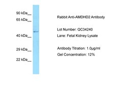 Aviva Systems Biology Corp AMDHD2 Antibody - N-terminal region (ARP63138_P050)