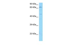 Aviva Systems Biology Corp NGFR Antibody - C-terminal region (ARP63279_P050)