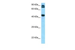 Aviva Systems Biology Corp DPP4 Antibody - C-terminal region (ARP63319_P050)