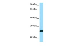Aviva Systems Biology Corp CTSH Antibody - C-terminal region (ARP63370_P050)