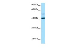 Aviva Systems Biology Corp CCNB2 Antibody - C-terminal region (ARP63411_P050)