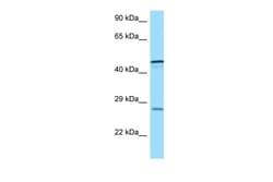 Aviva Systems Biology Corp TREM1 Antibody - C-terminal region (ARP63526_P050)