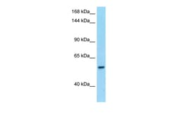 Aviva Systems Biology Corp PDE6B Antibody - N-terminal region (ARP63581_P050)