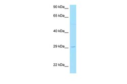 Aviva Systems Biology Corp LAT2 Antibody - C-terminal region (ARP63637_P050)