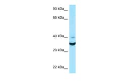Aviva Systems Biology Corp NCR1 Antibody - N-terminal region (ARP63659_P050)