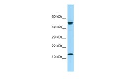 Aviva Systems Biology Corp GYPA Antibody - N-terminal region (ARP63746_P050)