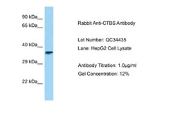 Aviva Systems Biology Corp CTBS Antibody - C-terminal region (ARP63779_P050)