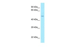 Aviva Systems Biology Corp AAMP Antibody - middle region (ARP64382_P050)