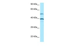 Aviva Systems Biology Corp TUBA1A Antibody - N-terminal region (ARP64534_P050)