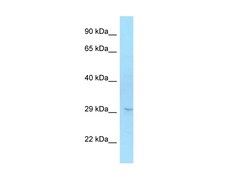 Aviva Systems Biology Corp ELOVL6 Antibody - C-terminal region (ARP64565_P050)