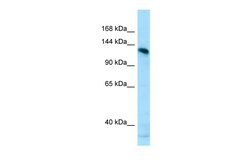 Aviva Systems Biology Corp AMPD2 Antibody - N-terminal region (ARP64642_P050)